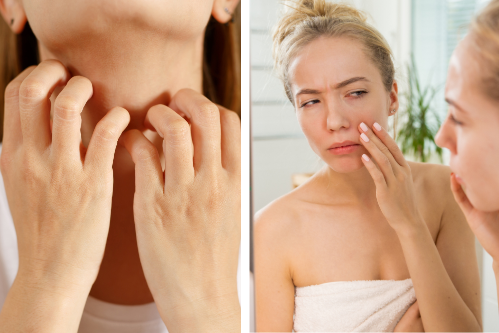 Donna con pelle irritata di collo e viso, disagio della pelle e necessità di concederle calma nella cura